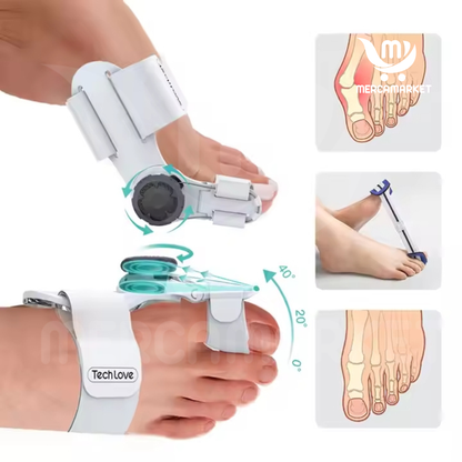 Corrector ortopedico para juanetes-Evita que el problema avance: corrige desde casa