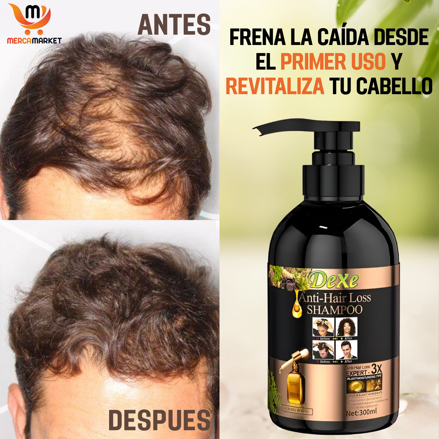 [💎 PRECIO IMPORTADOR + REGALO] Shampoo Especializado en Anticaída y Crecimiento con 5% de Minoxidil