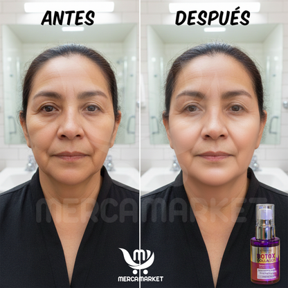2X1 BOTOX SERUM