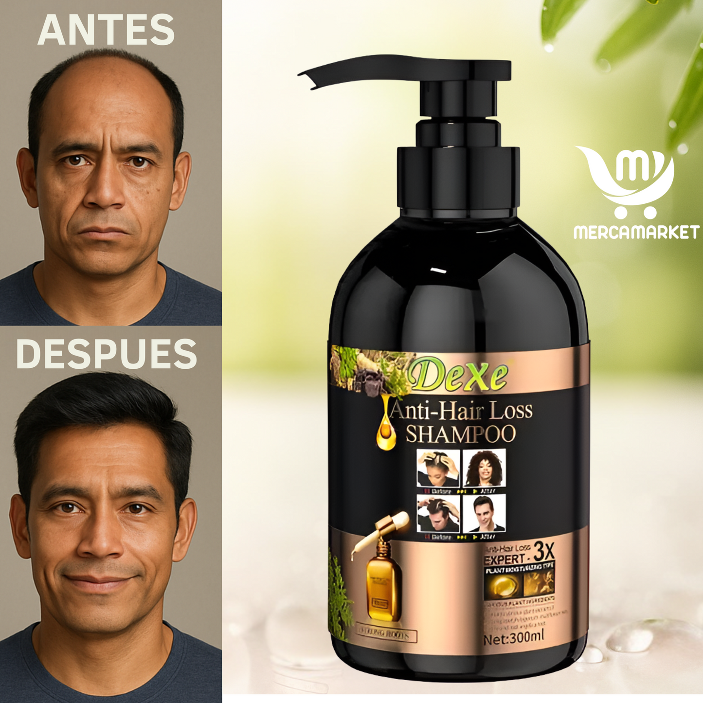 Shampoo Especializado en Anticaída y Crecimiento - Recupera tu Cabello al Instante