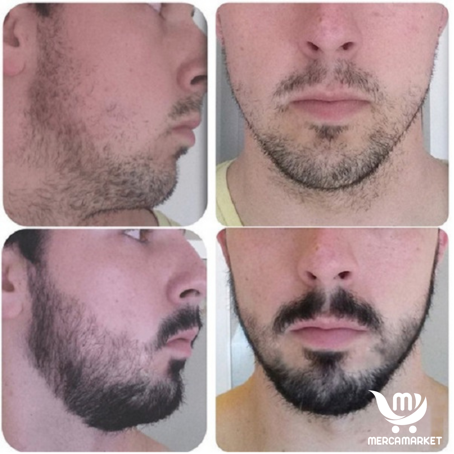 2X1 Aceite Premium para barba- Crecimiento Real desde Cero