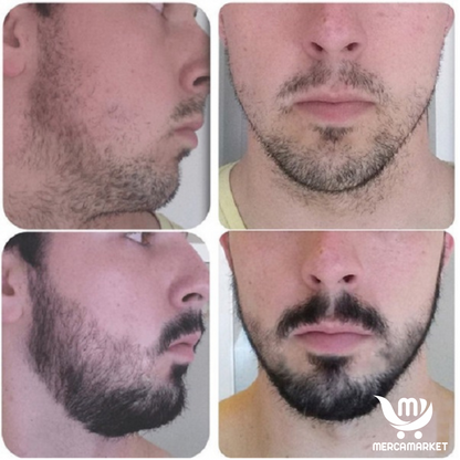 2X1 Aceite Premium para barba- Crecimiento Real desde Cero
