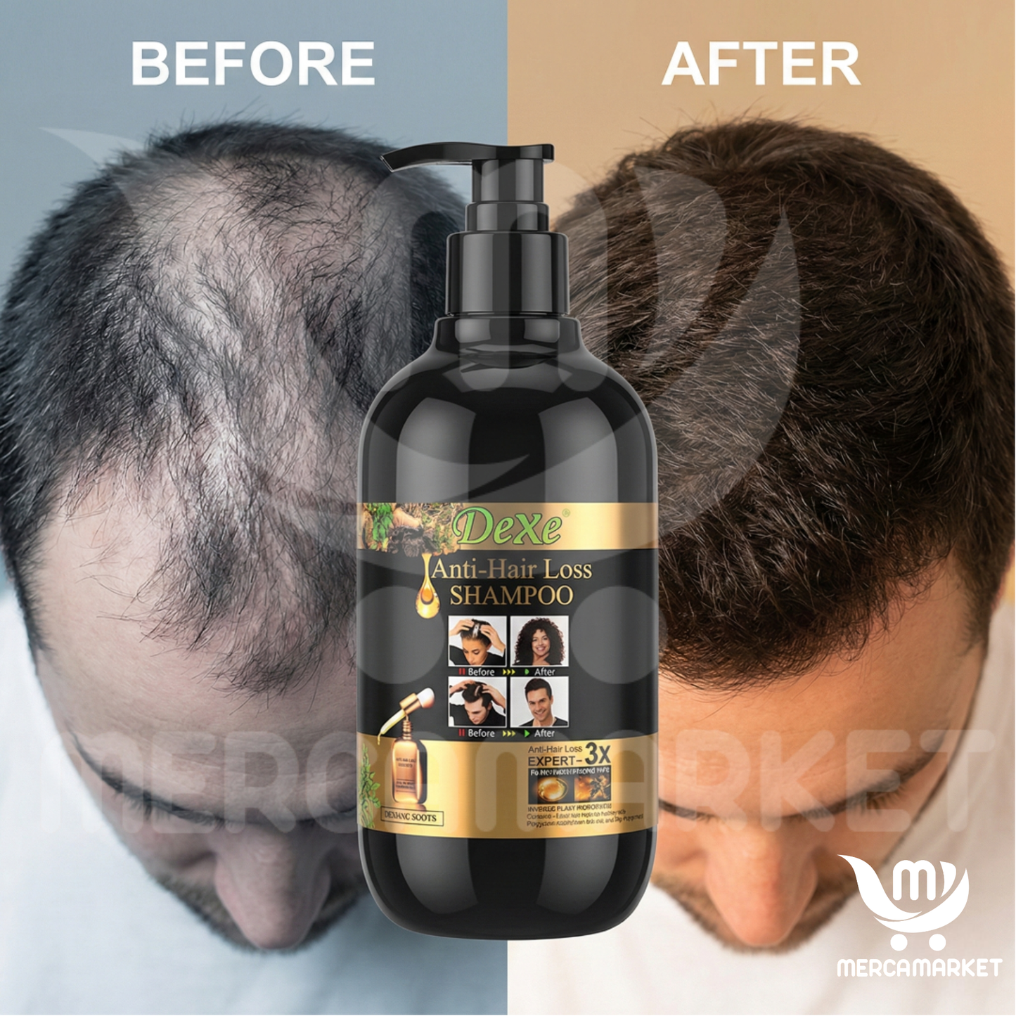 [💎 PRECIO IMPORTADOR + REGALO] Shampoo Especializado en Anticaída y Crecimiento con 5% de Minoxidil