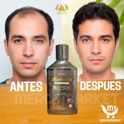 Shampoo Especializado en Anticaída y Crecimiento - Recupera tu Cabello al Instante
